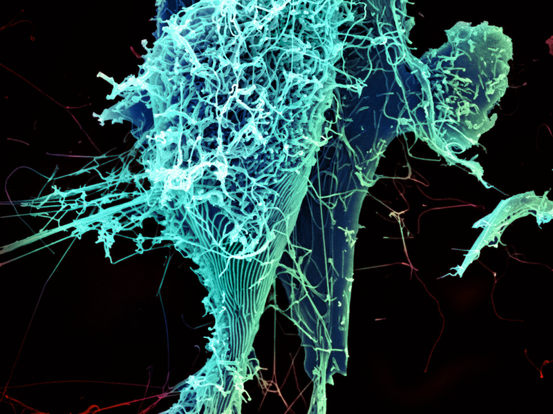 Illustration for article titled The Astounding And Horrific World As Seen Under A Microscope